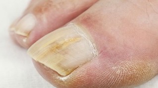 Anerer sprooch liesen